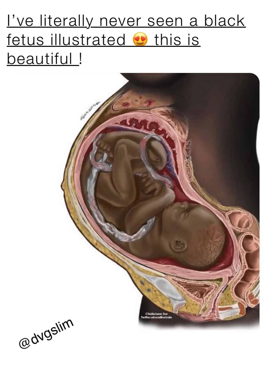 I’ve literally never seen a black fetus illustrated 😍 this is beautiful !