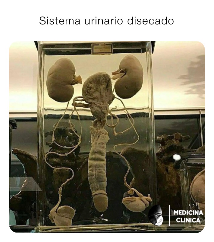 Sistema urinario disecado