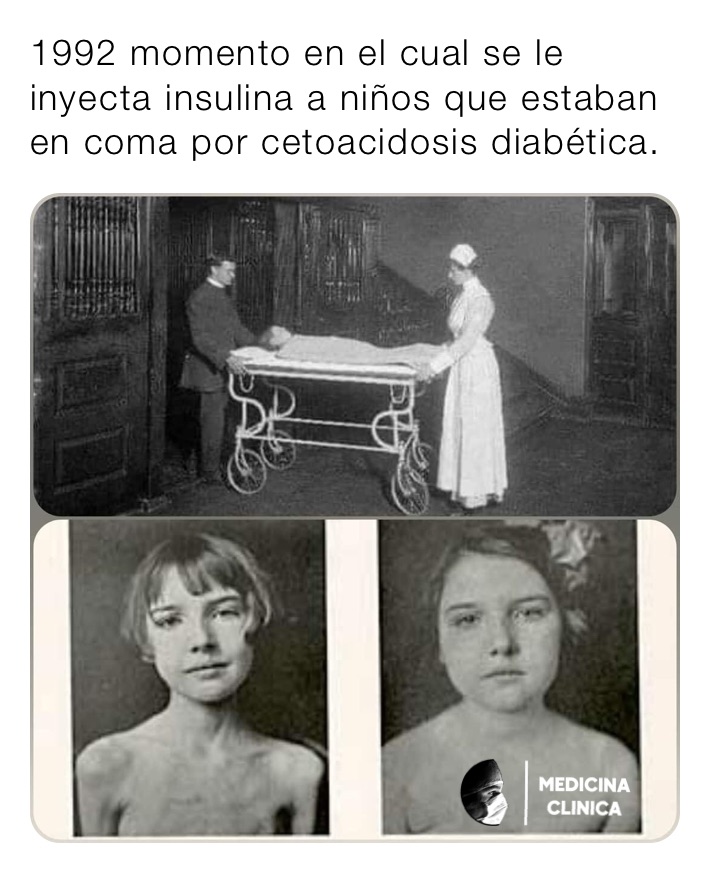 1992 momento en el cual se le inyecta insulina a niños que estaban en coma por cetoacidosis diabética. 