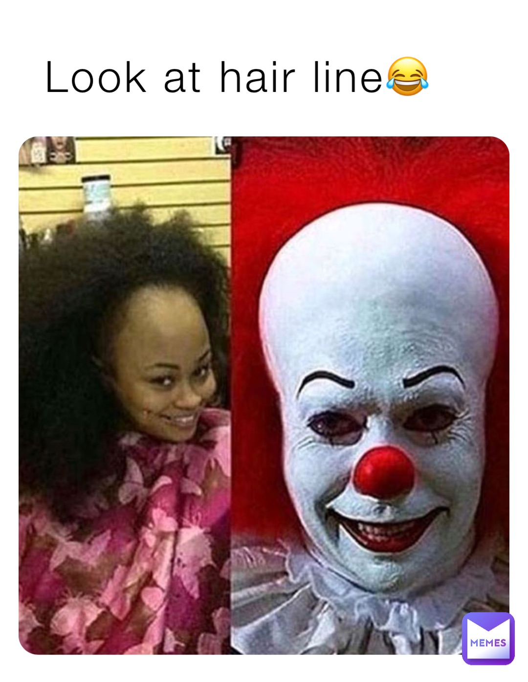 Look at hair line😂