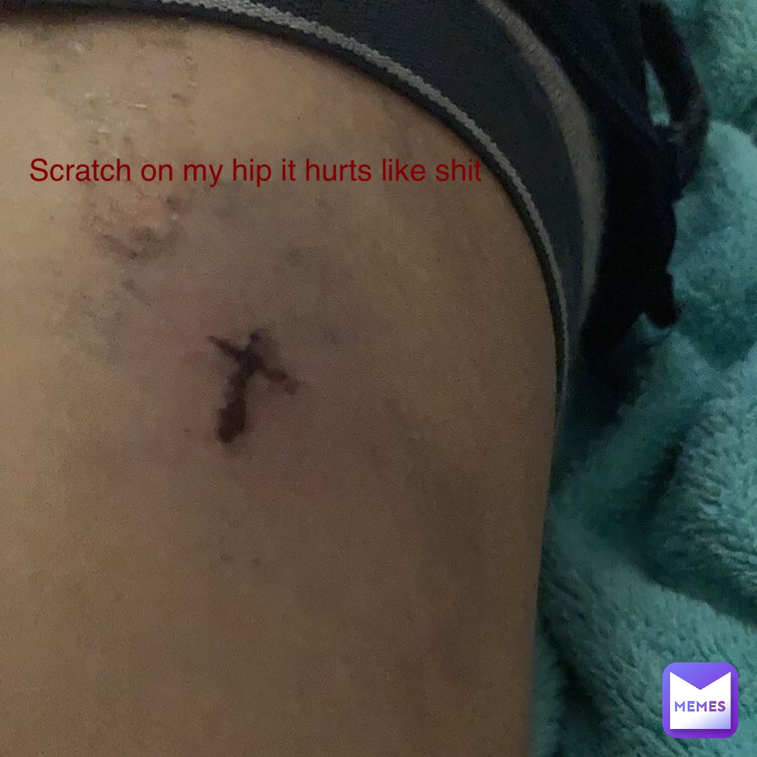 scratch on my hip it hurts like shit