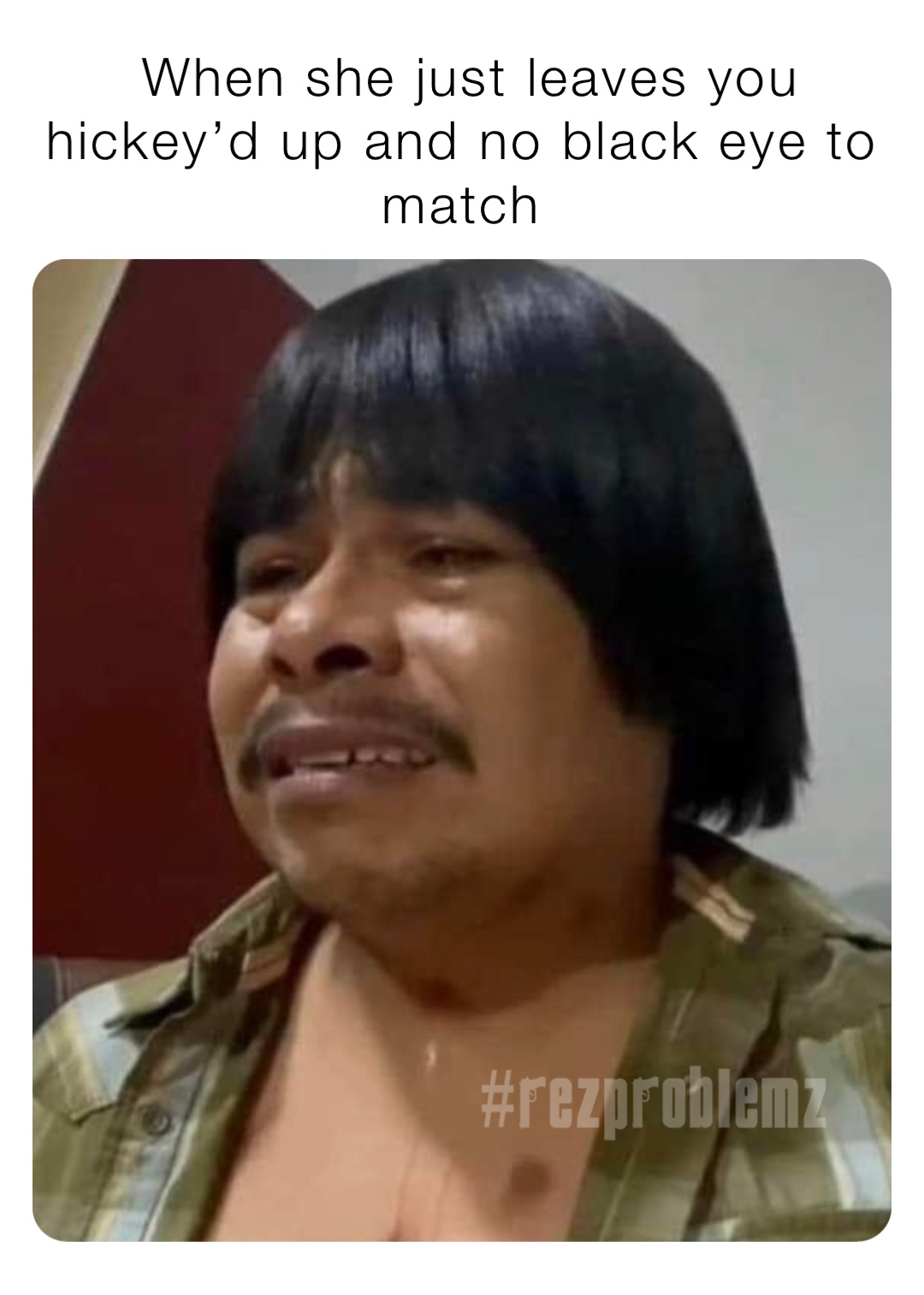 When she just leaves you hickey’d up and no black eye to match Rez