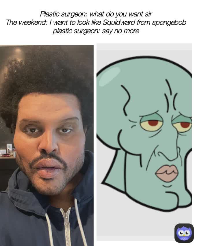 Plastic surgeon: what do you want sir
The weekend: I want to look like Squidward from spongebob
plastic surgeon: say no more
