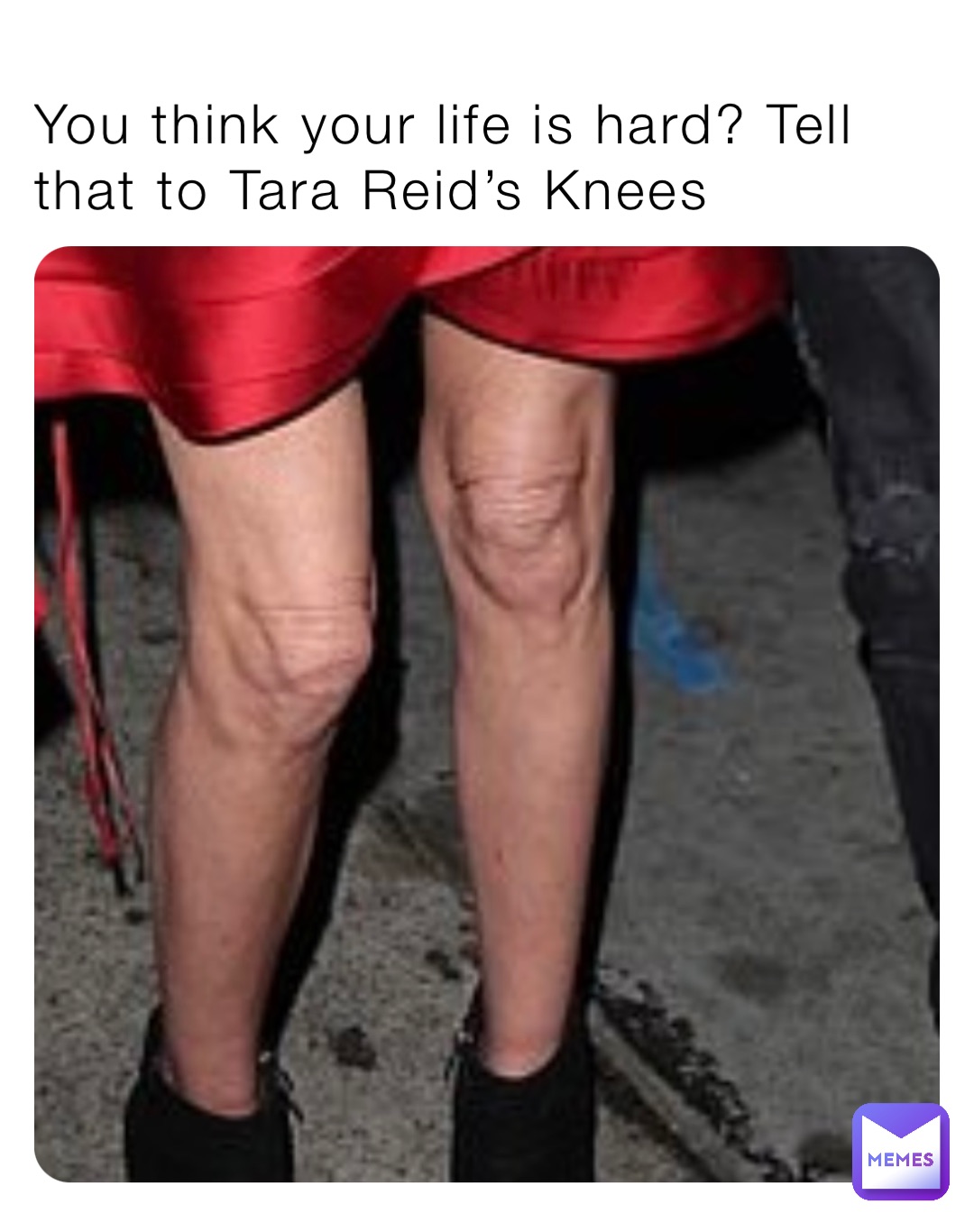 You think your life is hard? Tell that to Tara Reid’s Knees