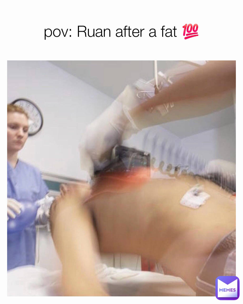 pov: Ruan after a fat 💯