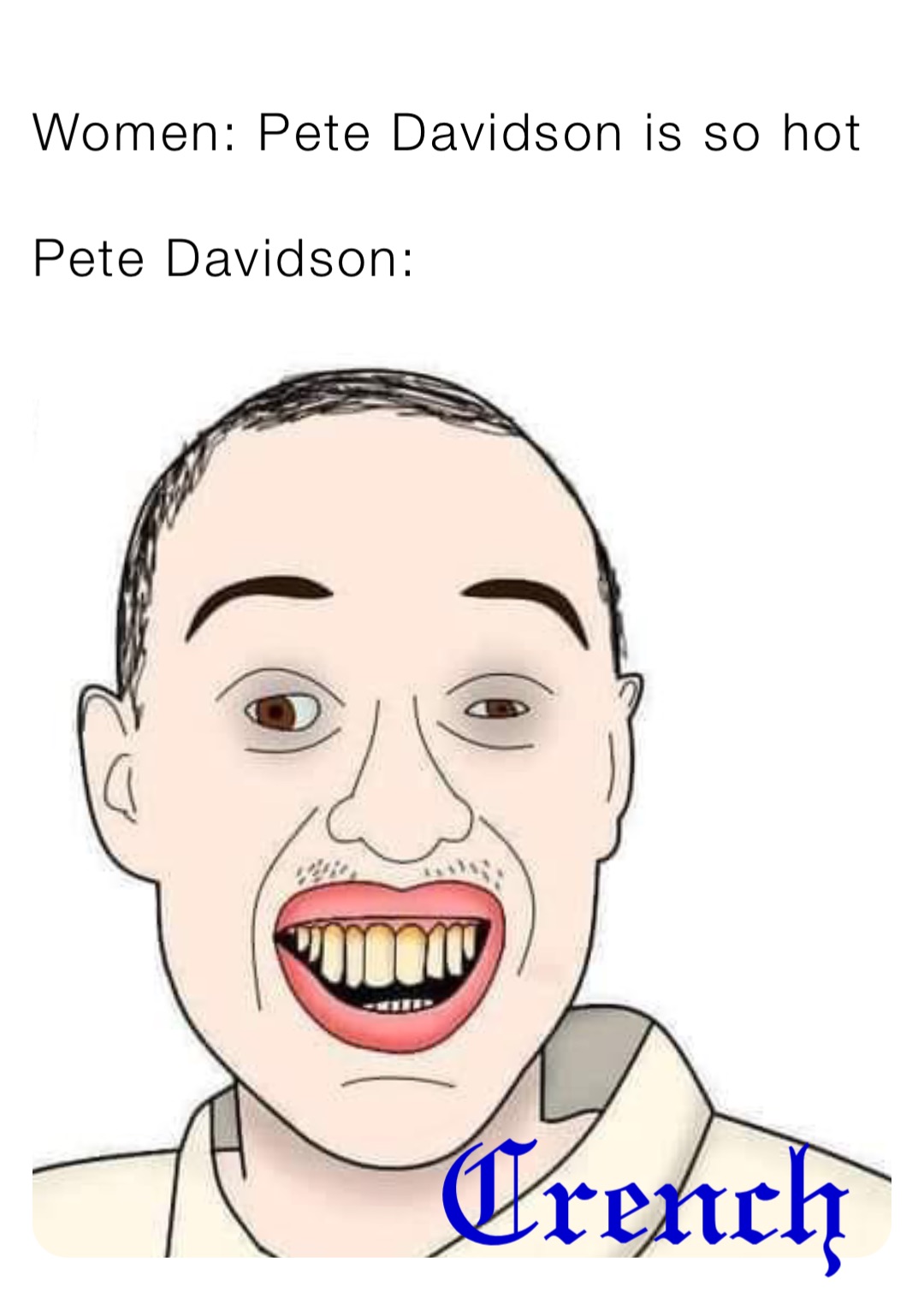 Women: Pete Davidson is so hot

Pete Davidson: