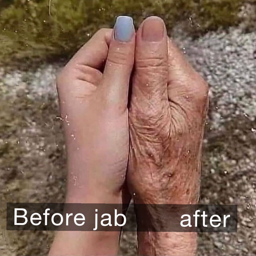 Before jab       After