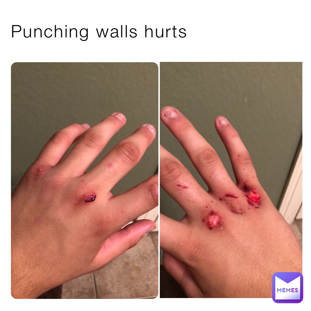 Punching walls hurts