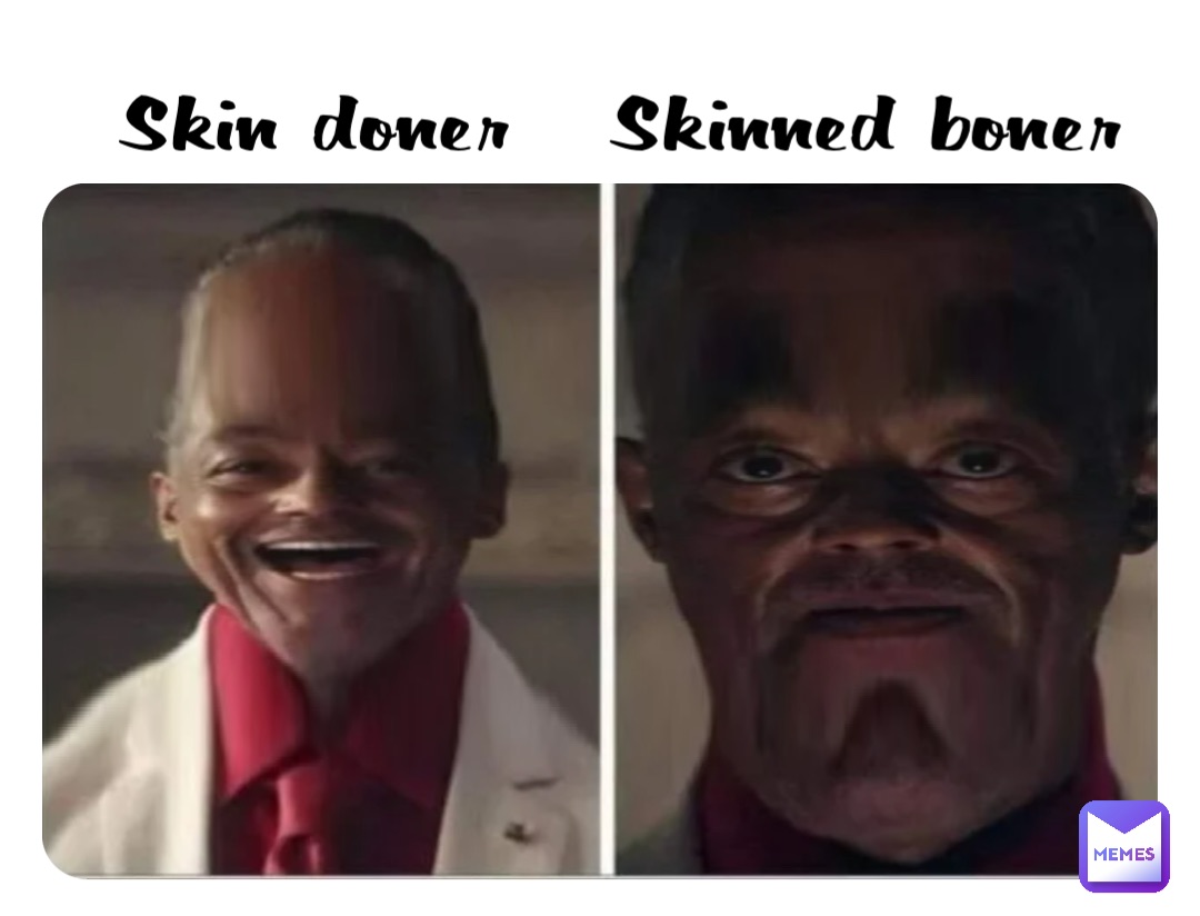 Skin doner   Skinned boner