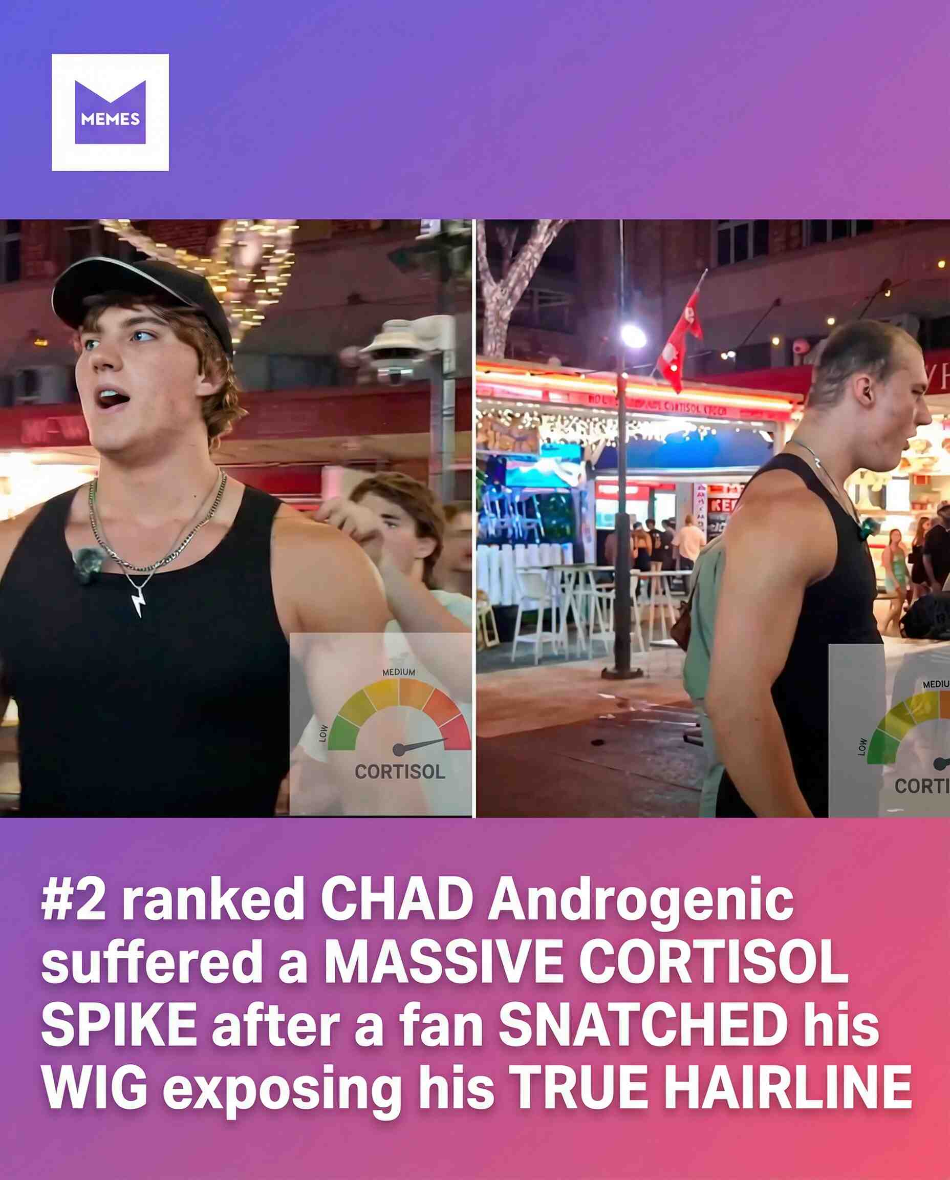 The #2 ranked CHAD Androgenic experienced what fans are calling a MASSIVE cortisol spike after a shocking moment unfolded in front of a live crowd. In a split second, a fan allegedly SNATCHED his wig — exposing what many are now calling his “true hairline.” The unexpected reveal sent the audience into chaos, turning what was supposed to be a routine appearance into viral internet history. Whether it was a prank gone wrong or a deliberate stunt, one thing is clear: the internet will never forget this moment. 😳