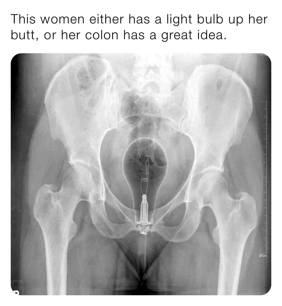 She probably felt so enlightened.. #hospitallife #medicalhumor #hospitalmemes #nursesbelike