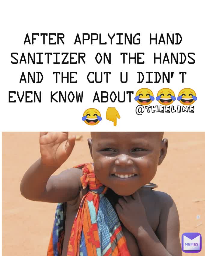 @theeline after applying hand sanitizer on the hands and the cut u didn't even know about😂😂😂😂👇