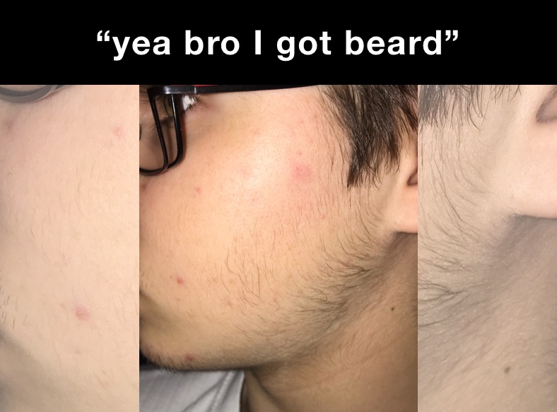 “yea bro I got beard”