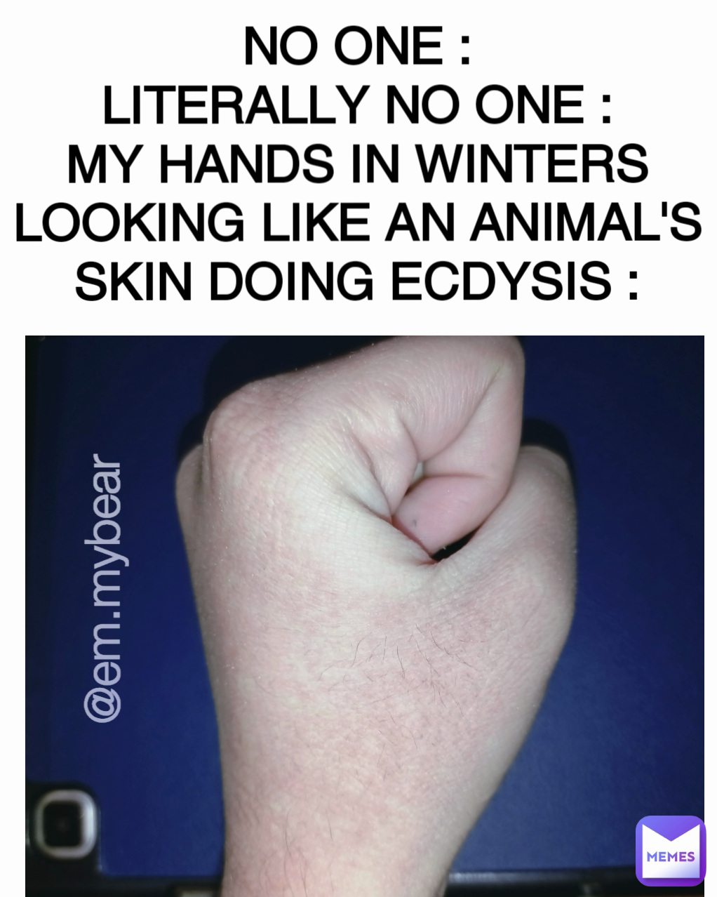 NO ONE :
LITERALLY NO ONE :
MY HANDS IN WINTERS LOOKING LIKE AN ANIMAL'S SKIN DOING ECDYSIS : @em.mybear