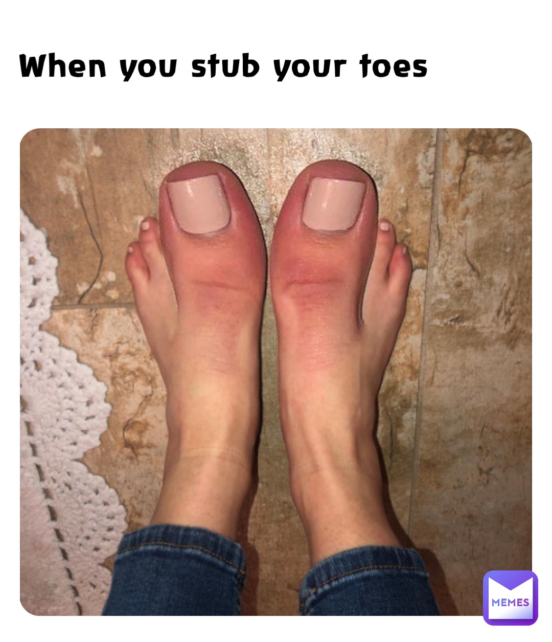 When you stub your toes