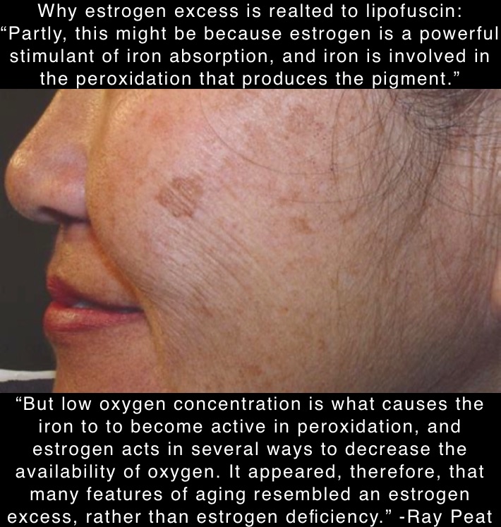 Why estrogen excess is realted to lipofuscin: 
“Partly, this might be because estrogen is a powerful stimulant of iron absorption, and iron is involved in the peroxidation that produces the pigment.” “But low oxygen concentration is what causes the iron to to become active in peroxidation, and estrogen acts in several ways to decrease the availability of oxygen. It appeared, therefore, that many features of aging resembled an estrogen excess, rather than estrogen deficiency.” -Ray Peat