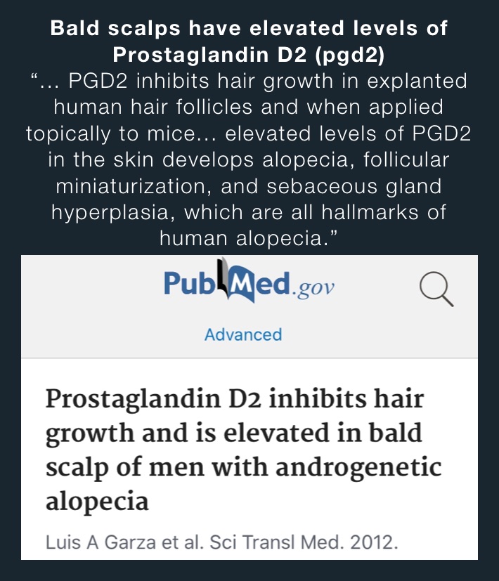Bald scalps have elevated levels of Prostaglandin D2 (pgd2) “... PGD2  inhibits hair growth in explanted human