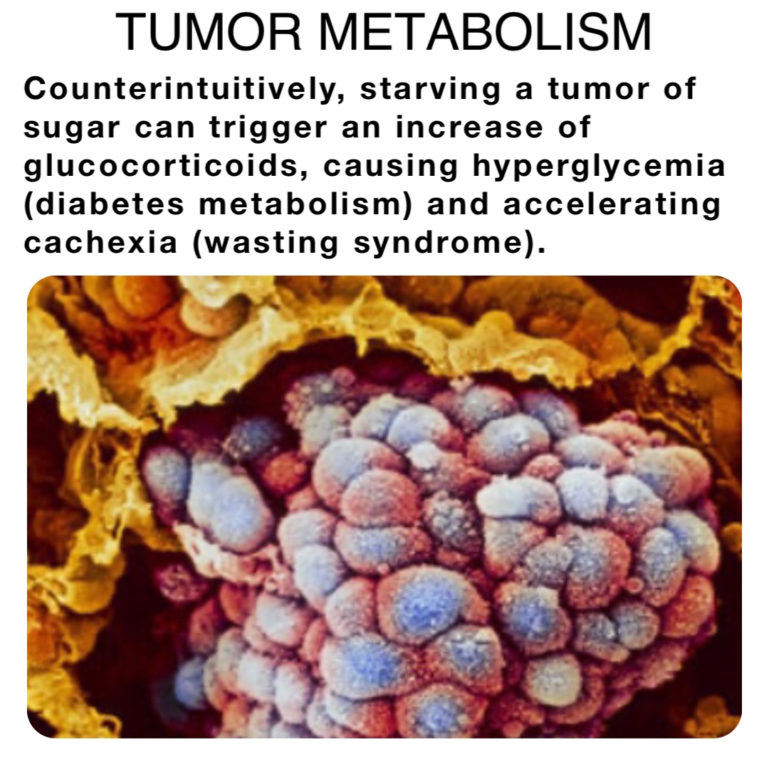 Counterintuitively, starving a tumor of sugar can trigger an increase of glucocorticoids, causing hyperglycemia (diabetes metabolism) and accelerating cachexia (wasting syndrome). TUMOR METABOLISM