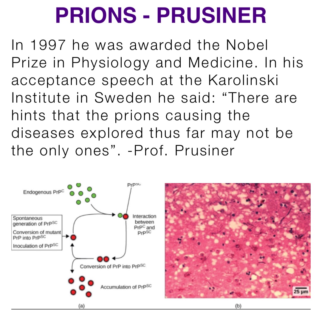 In 1997 he was awarded the Nobel Prize in Physiology and Medicine. In his acceptance speech at the Karolinski Institute in Sweden he said: “There are hints that the prions causing the diseases explored thus far may not be the only ones”. -Prof. Prusiner PRIONS - PRUSINER