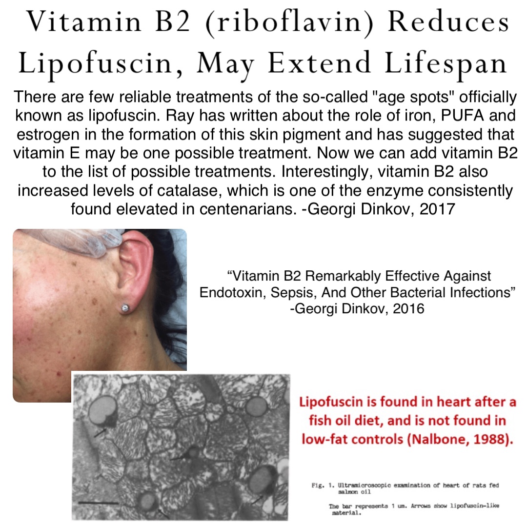 Vitamin B2 (riboflavin) Reduces Lipofuscin, May Extend Lifespan There are few reliable treatments of the so-called "age spots" officially known as lipofuscin. Ray has written about the role of iron, PUFA and estrogen in the formation of this skin pigment and has suggested that vitamin E may be one possible treatment. Now we can add vitamin B2 to the list of possible treatments. Interestingly, vitamin B2 also increased levels of catalase, which is one of the enzyme consistently found elevated in centenarians. -Georgi Dinkov, 2017 “Vitamin B2 Remarkably Effective Against Endotoxin, Sepsis, And Other Bacterial Infections”
-Georgi Dinkov, 2016