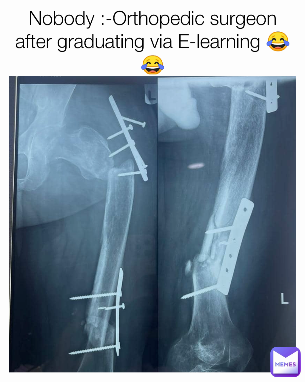 Nobody :-Orthopedic surgeon after graduating via E-learning 😂😂