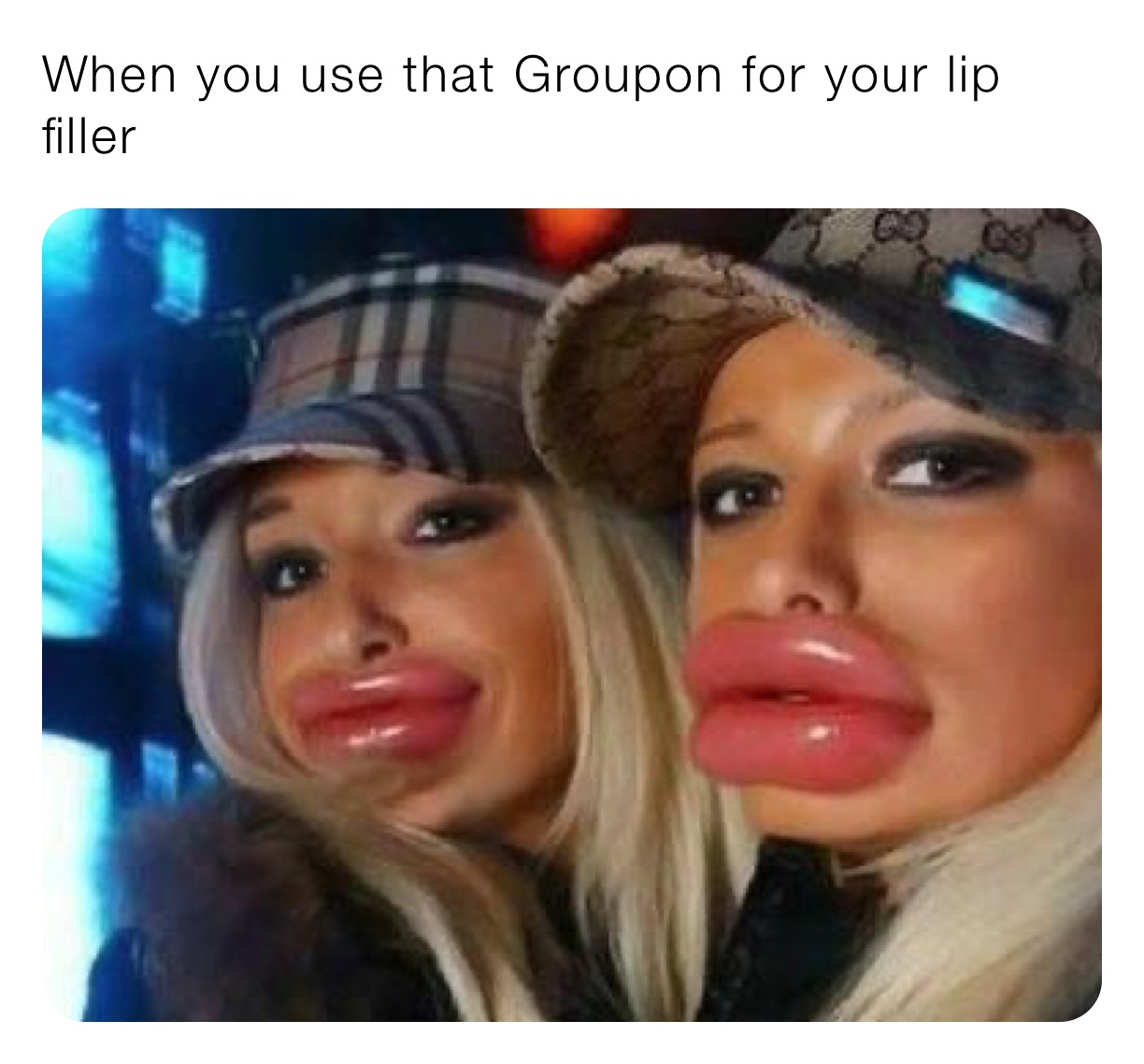 When you use that Groupon for your lip filler 