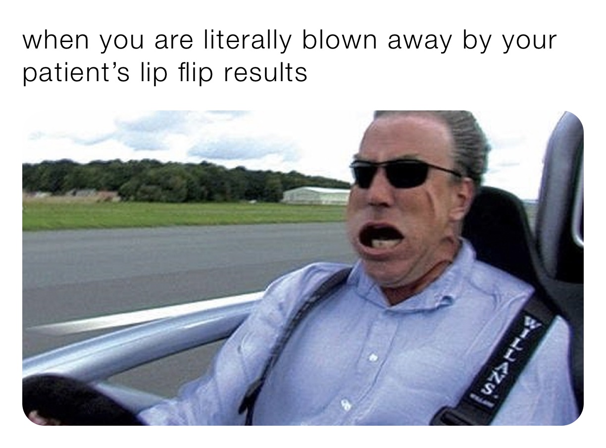 when you are literally blown away by your patient’s lip flip results 