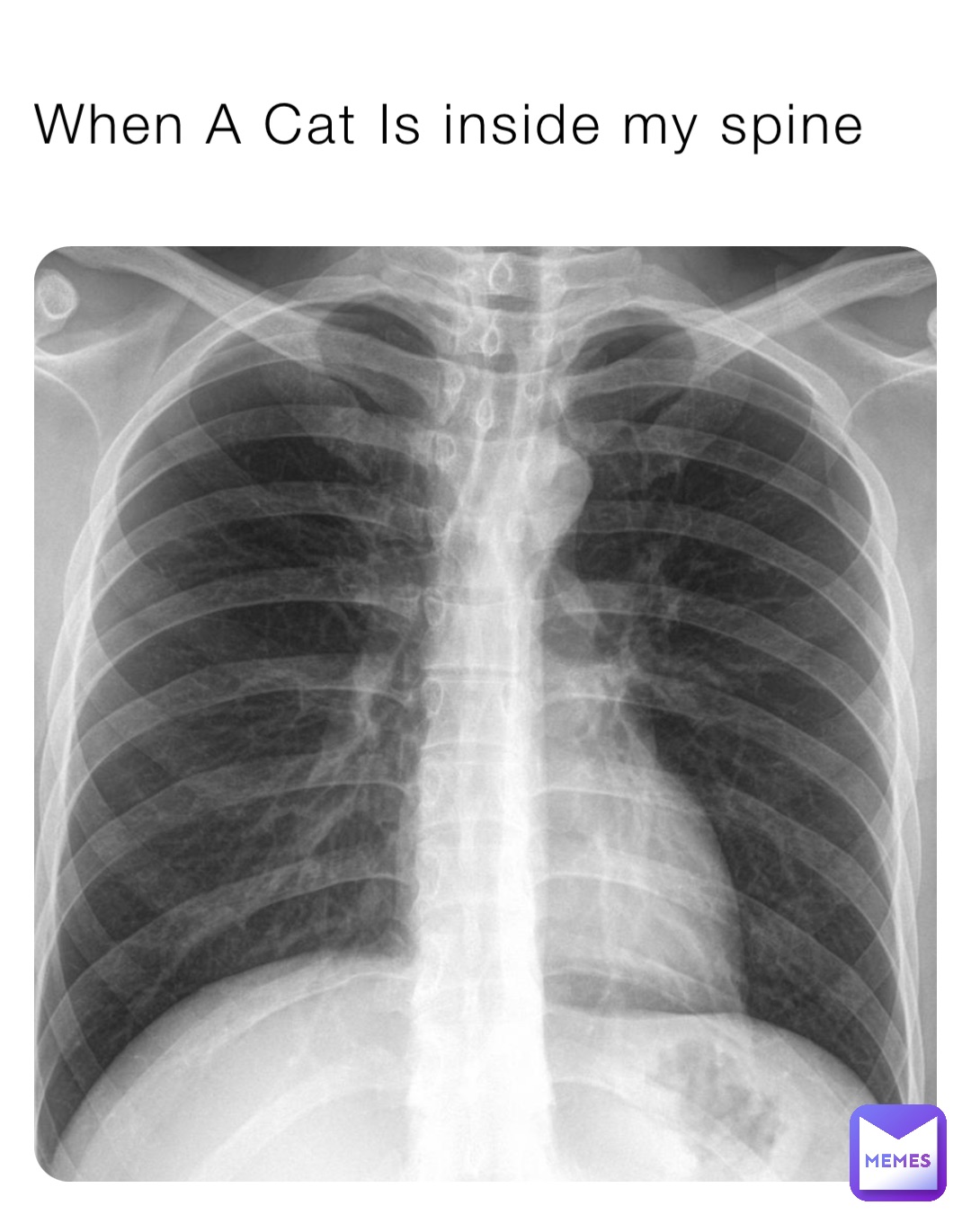 When A Cat Is inside my spine