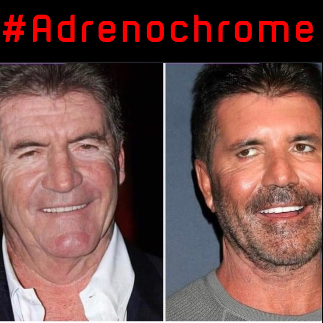 #Adrenochrome