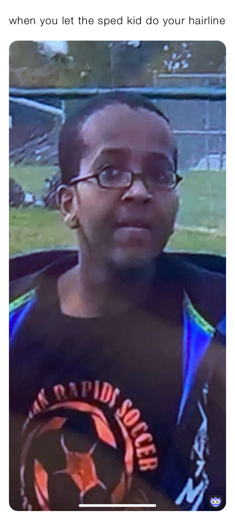 when you let the sped kid do your hairline