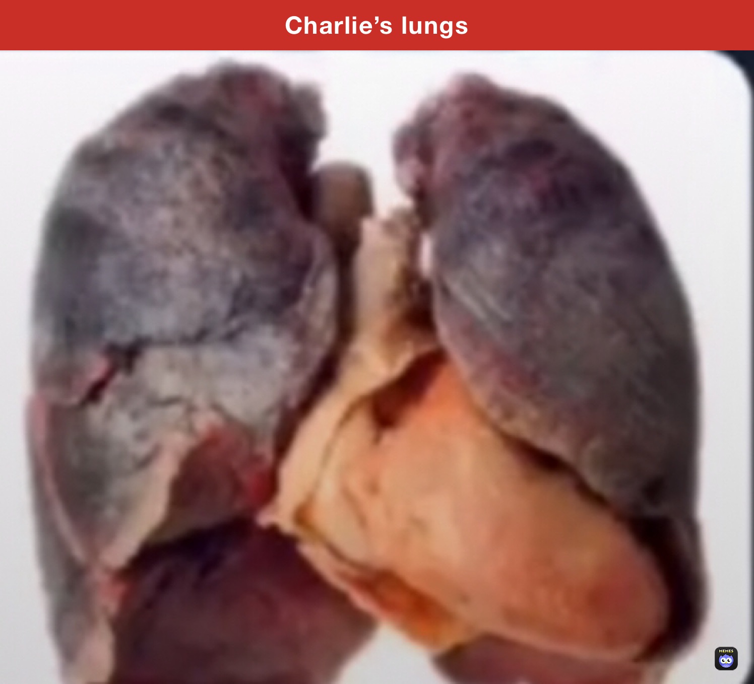 Charlie’s lungs