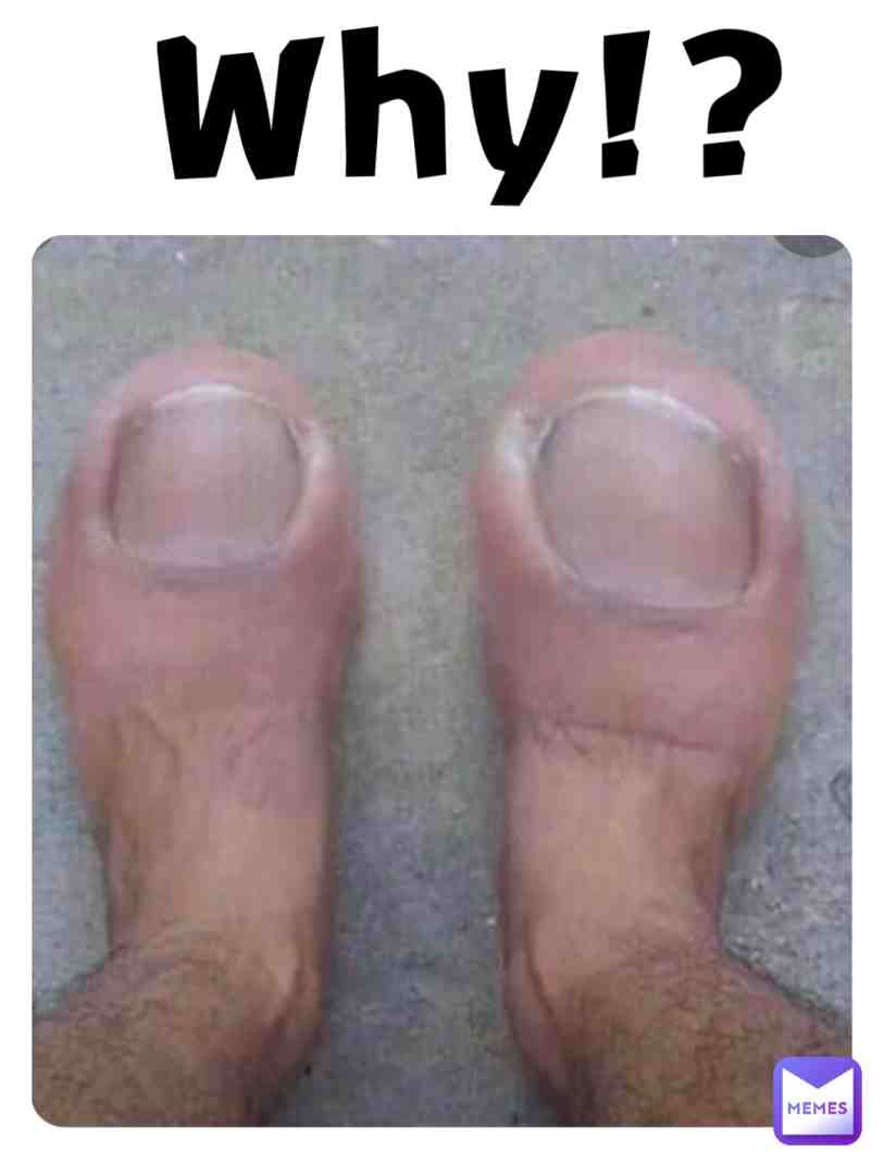 #pain #why