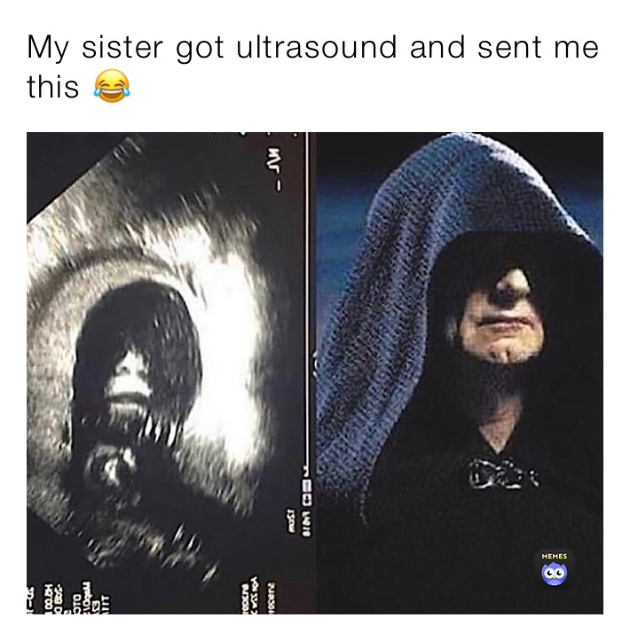 My sister got ultrasound and sent me this 😂
