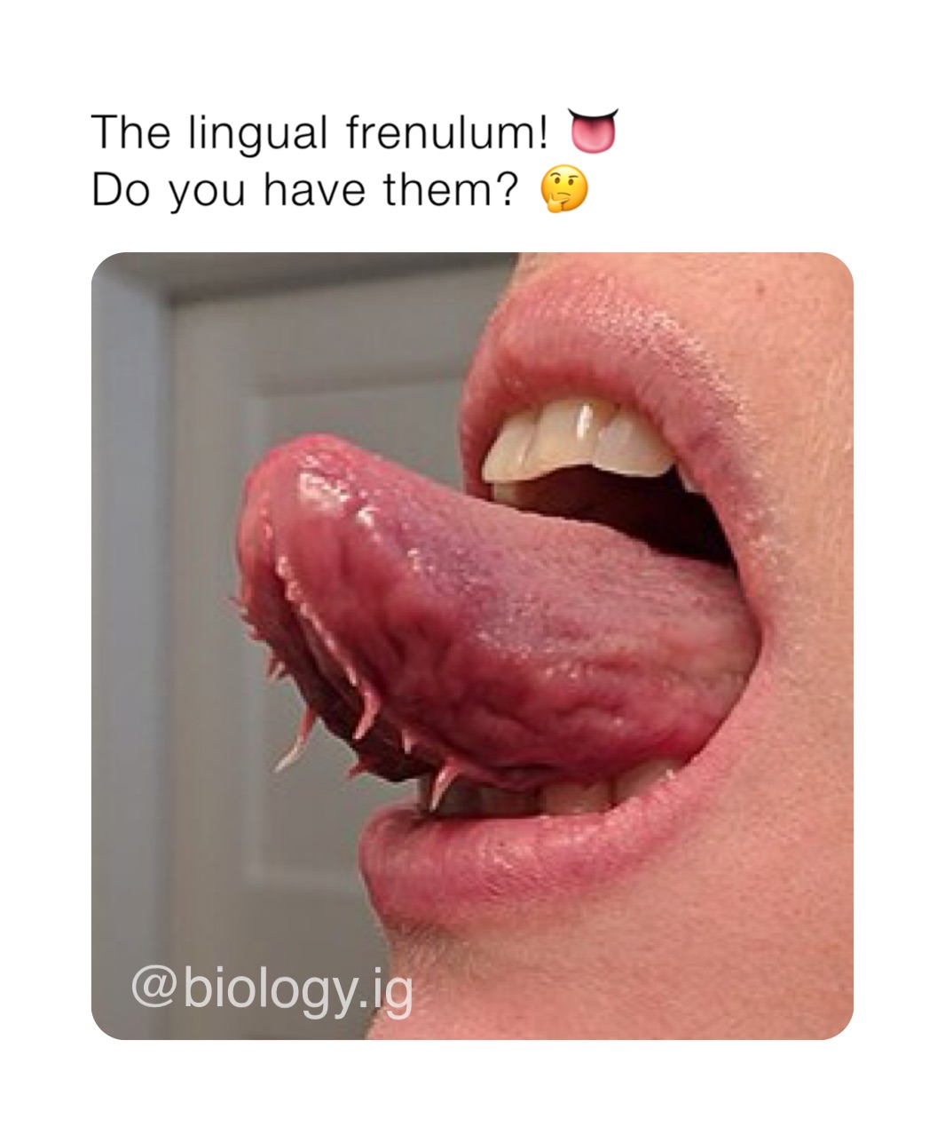 The lingual frenulum! 👅
Do you have them? 🤔