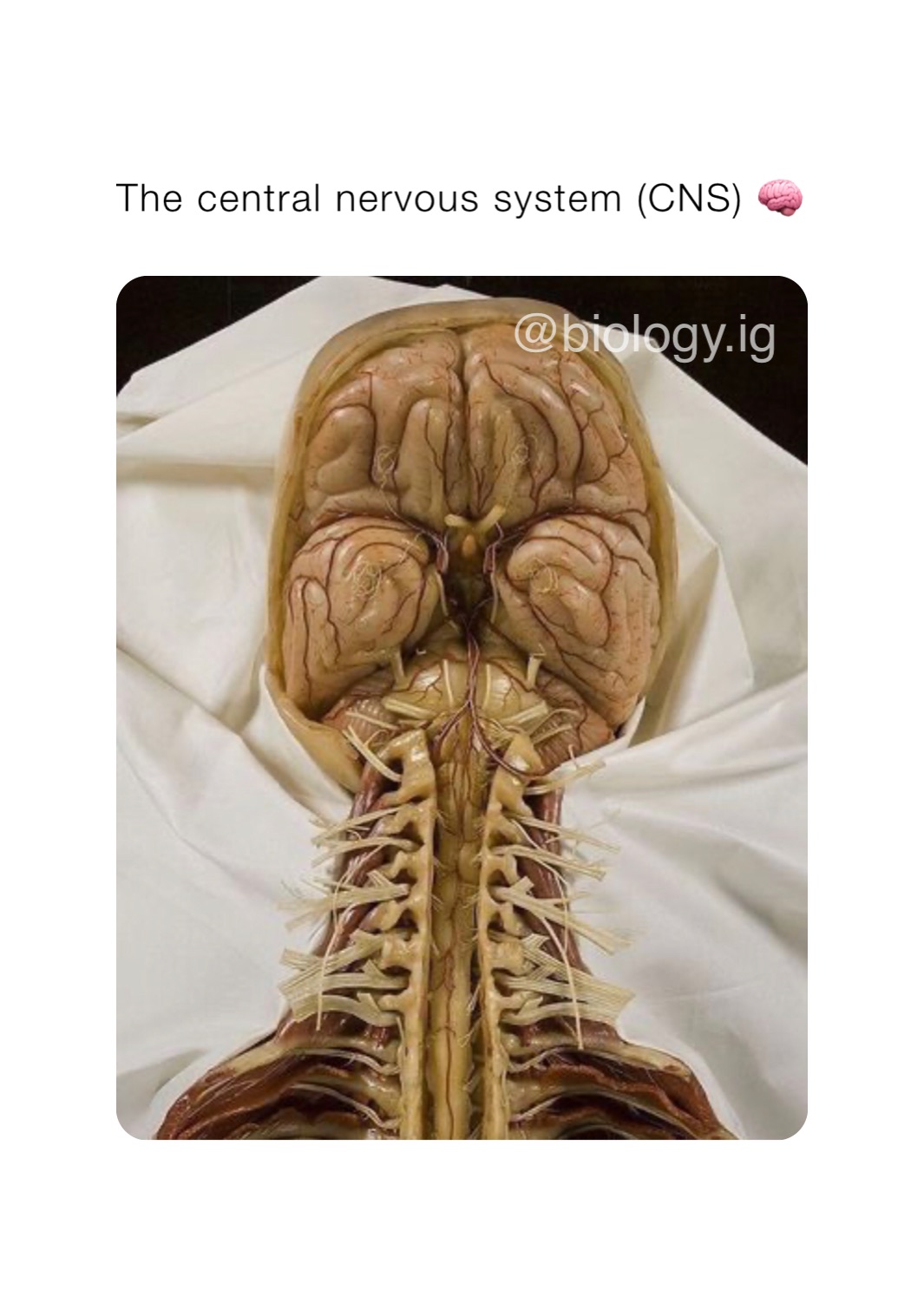 The central nervous system (CNS) 🧠