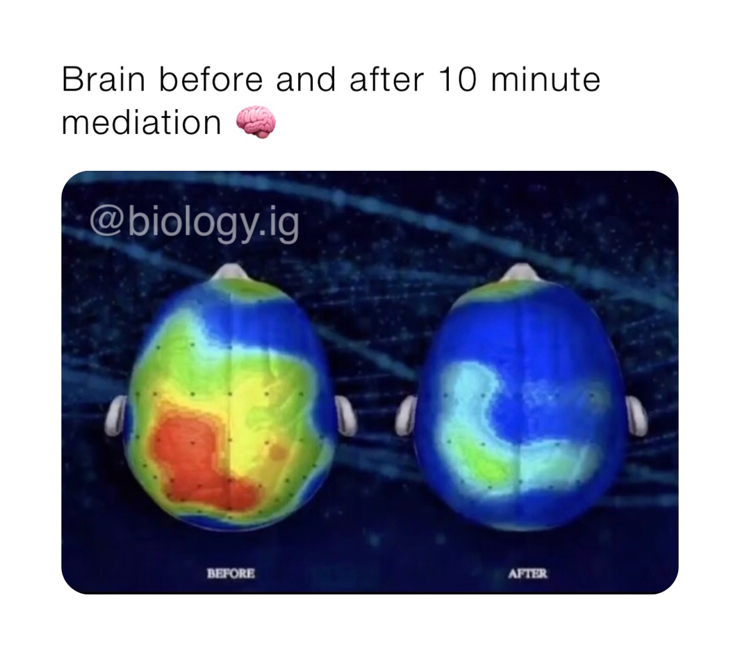 Brain before and after 10 minute mediation 🧠