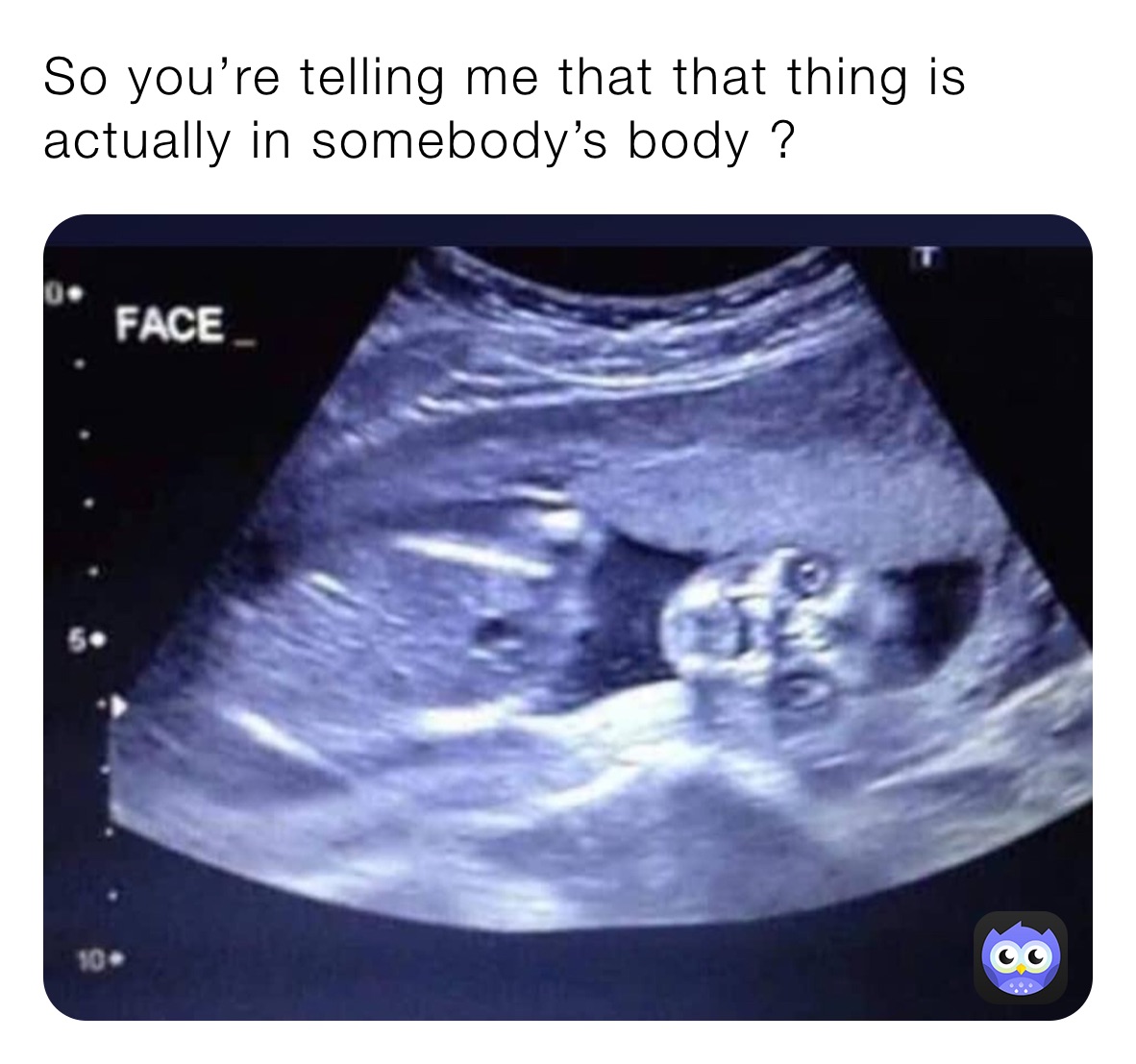 So you’re telling me that that thing is actually in somebody’s body ?