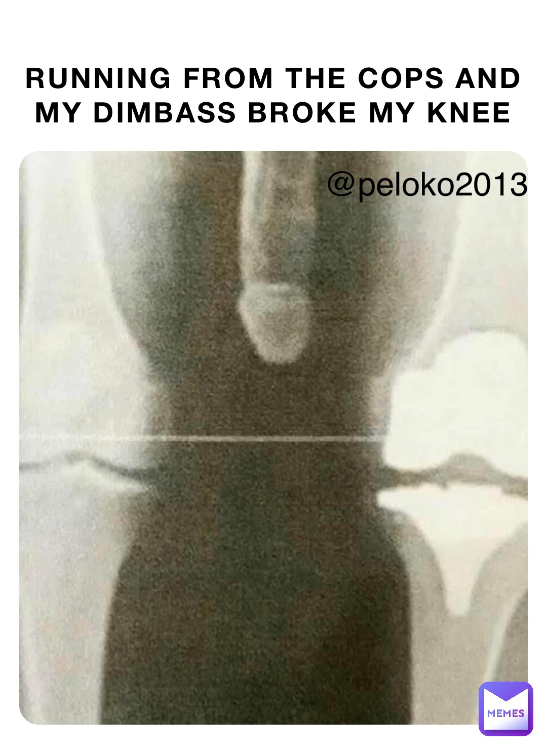 Running from the cops and my dimbass broke my knee @peloko2013