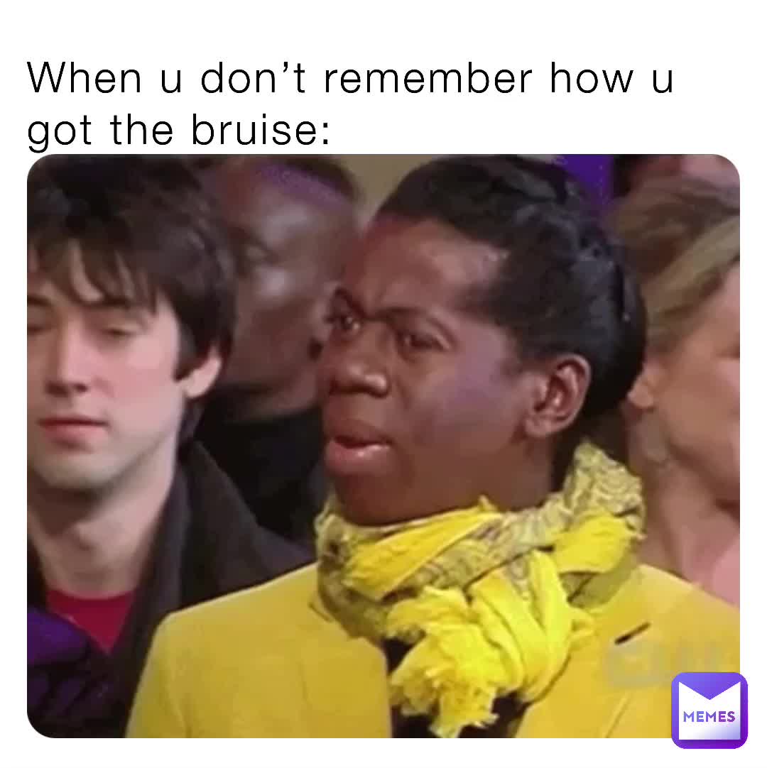 When u don’t remember how u got the bruise Unsaid_Emily1 Memes