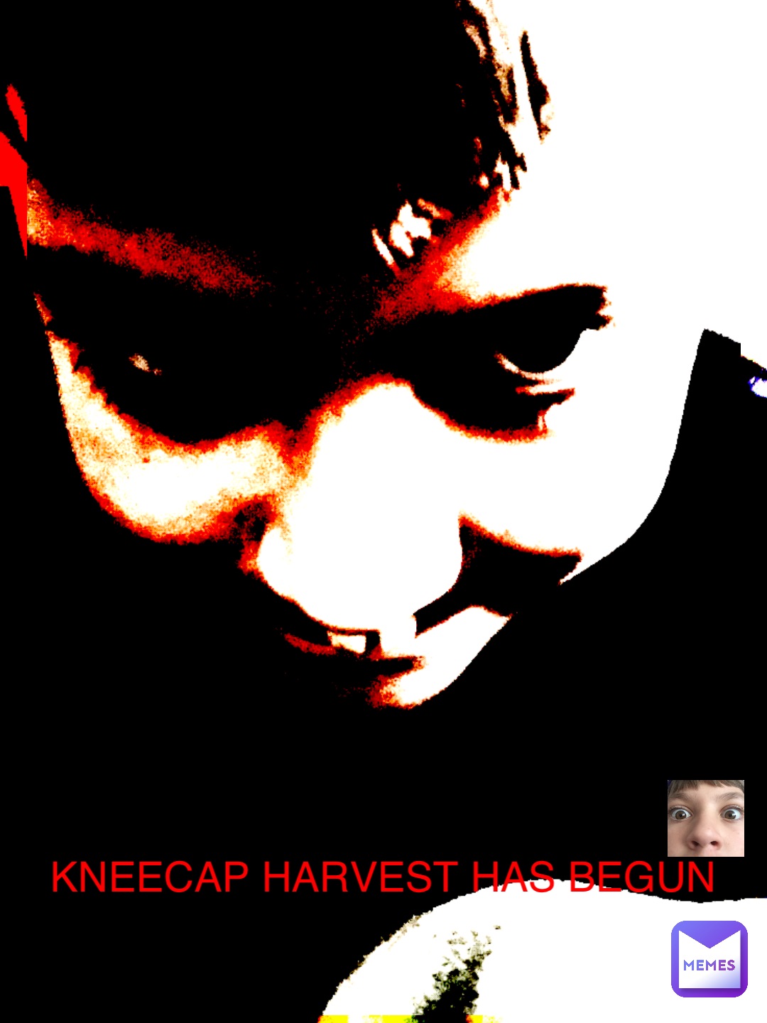 KNEECAP HARVEST HAS BEGUN KNEECAP HARVEST HAS BEGUN