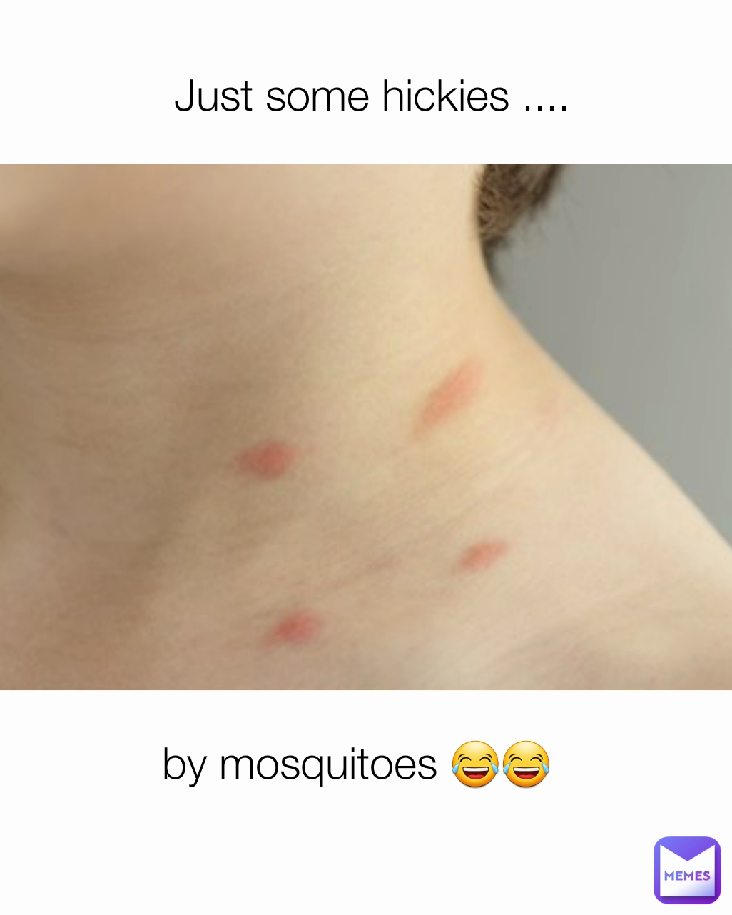 Just some hickies .... by mosquitoes 😂😂