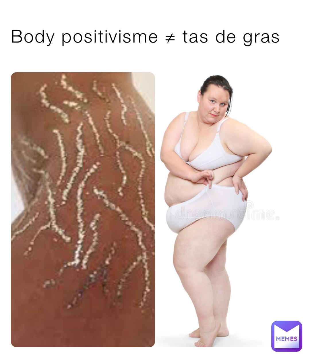 Body positivisme ≠ tas de gras