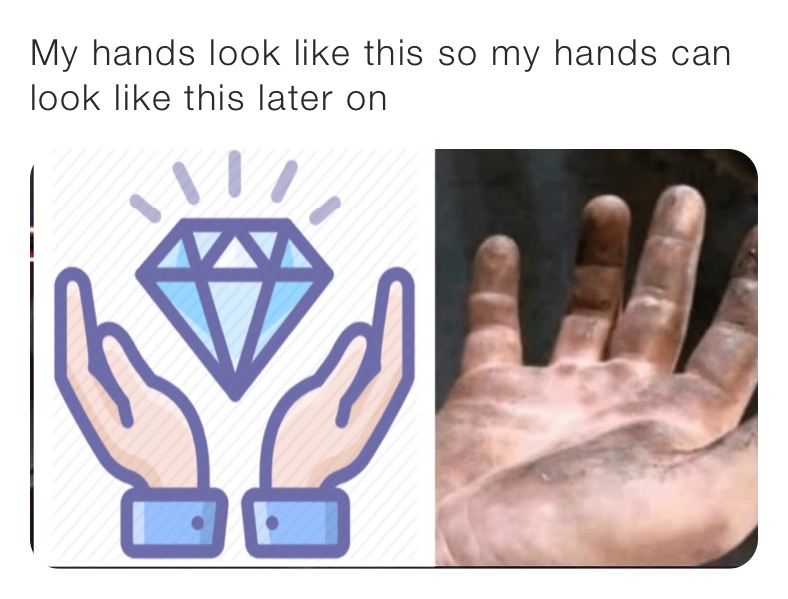My hands look like this so my hands can look like this later on 