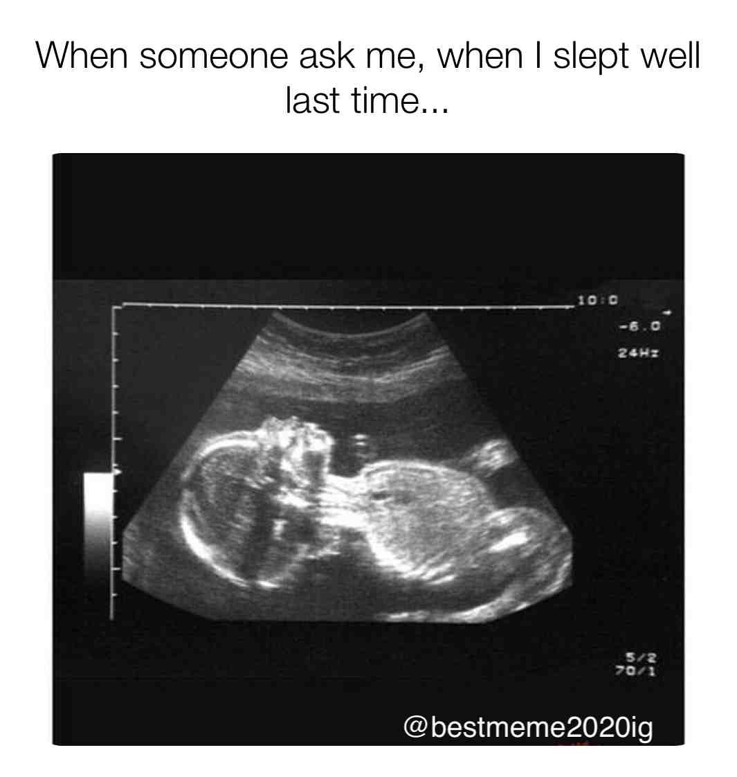  #viralteam #viralmeme #viralpost #virals #memesdank #videomemes #memes4ever #videosfunny #dailyvideo #crazyvideo #dark_humor #darkhumoristhebesthumor #darkhumorjokes #darkhumormeme #darkhumorclub #darkhumormemes #darkhumor #wierdmemes #funnyassmemes #legendarymemes #sensitivememes #dankassmemes #edgymemesforteens #stupidmemes #spicymemesdaily #follow4follow #follownow #followshoutoutlikecomment #likesforfollow #like4likeback