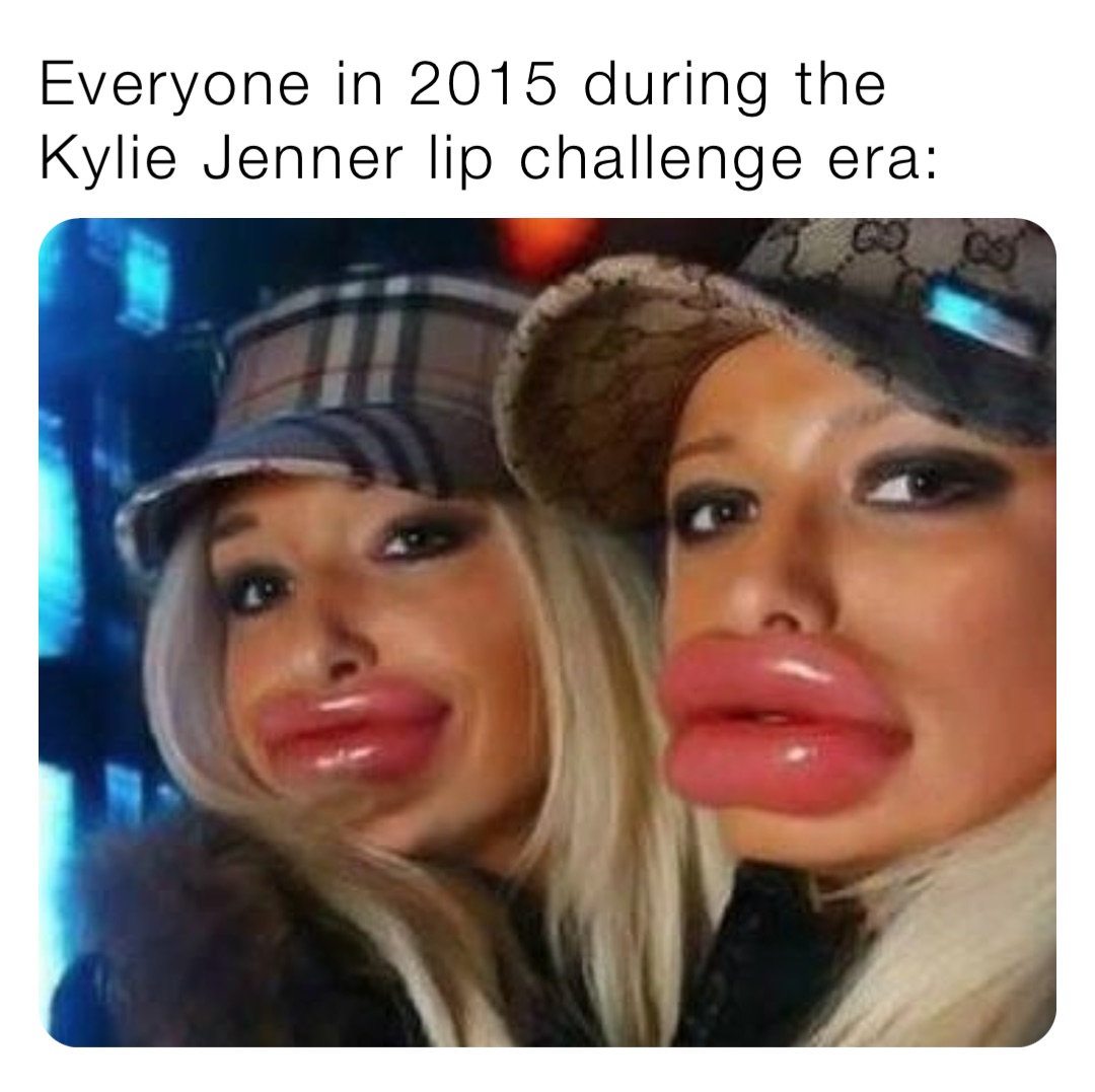 Everyone in 2015 during the Kylie Jenner lip challenge era: