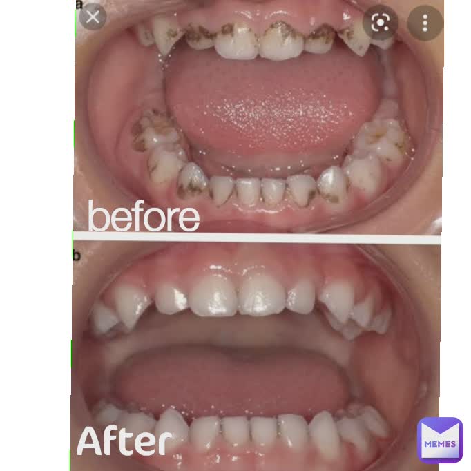 Meme by zataziza9999