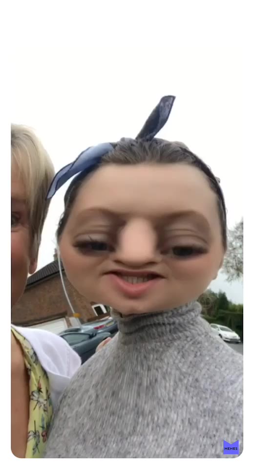 #nosejob  #plasticsurgery