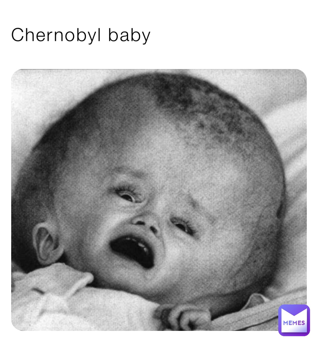 chernobyl baby mutations