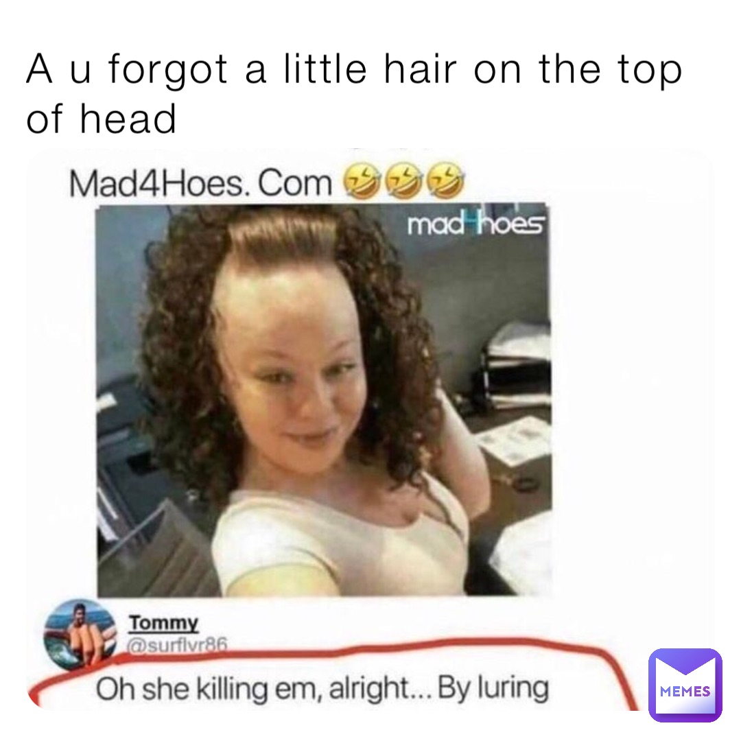 A u forgot a little hair on the top of head