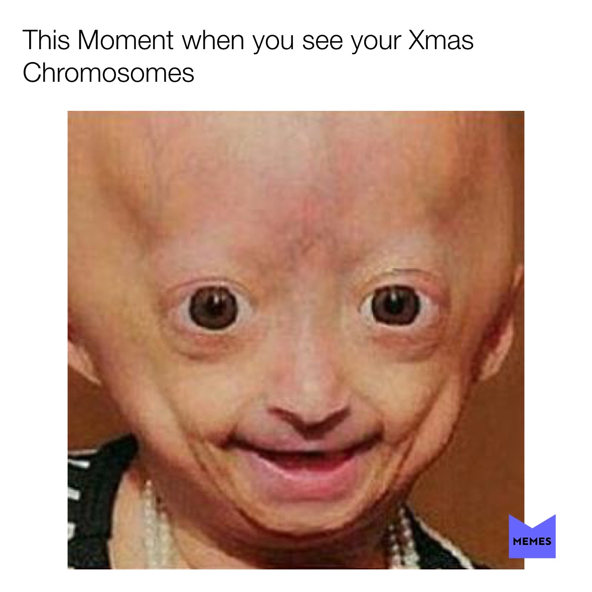 Post Traumatic Down Syndrome Meme TTFLX